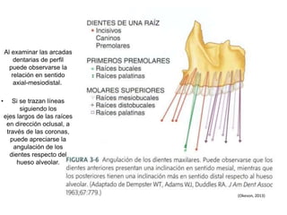 Al examinar las arcadas
dentarias de perfil
puede observarse la
relación en sentido
axial-mesiodistal.
• Si se trazan líneas
siguiendo los
ejes largos de las raíces
en dirección oclusal, a
través de las coronas,
puede apreciarse la
angulación de los
dientes respecto del
hueso alveolar.
(Okeson, 2013)
 