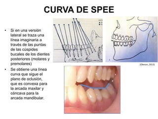 CURVA DE SPEE
• Si en una versión
lateral se traza una
línea imaginaria a
través de las puntas
de las cúspides
bucales de los dientes
posteriores (molares y
premolares)
• Se obtiene una línea
curva que sigue el
plano de oclusión,
que es convexa para
la arcada maxilar y
cóncava para la
arcada mandibular.
(Okeson, 2013)
 