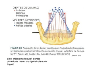 En la arcada mandibular, dientes
posteriores tienen una ligera inclinación
lingual.
(Okeson, 2013)
 