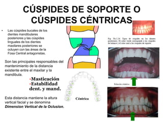 CÚSPIDES DE SOPORTE O
CÚSPIDES CÉNTRICAS
• Las cúspides bucales de los
dientes mandibulares
posteriores y las cúspides
linguales de los dientes
maxilares posteriores se
ocluyen con las áreas de la
Fosa Central antagonistas.
Son las principales responsables del
mantenimiento de la distancia
existente entre el maxilar y la
mandibula.
•Masticación
•Estabilidad
dent. y mand.
Esta distancia mantiene la altura
vertical facial y se denomina
Dimension Vertical de la Oclusion.
http://es.slideshare.net/pecosos/oclusion
 