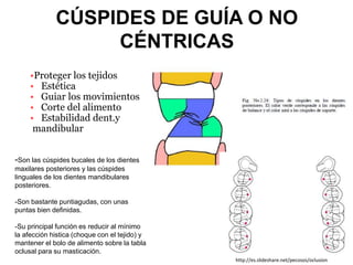 CÚSPIDES DE GUÍA O NO
CÉNTRICAS
•Proteger los tejidos
• Estética
• Guiar los movimientos
• Corte del alimento
• Estabilidad dent.y
mandibular
-Son las cúspides bucales de los dientes
maxilares posteriores y las cúspides
linguales de los dientes mandibulares
posteriores.
-Son bastante puntiagudas, con unas
puntas bien definidas.
-Su principal función es reducir al mínimo
la afección histica (choque con el tejido) y
mantener el bolo de alimento sobre la tabla
oclusal para su masticación.
http://es.slideshare.net/pecosos/oclusion
 