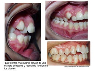 -Las fuerzas musculares actúan de una
manera constante y regulan la función de
los dientes.
http://es.slideshare.net/pecosos/oclusion
 