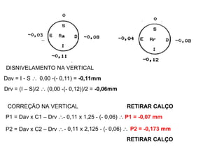 DISNIVELAMENTO NA VERTICAL
Dav = I - S  0,00 -(- 0,11) = -0,11mm
Drv = (I – S)/2  (0,00 -(- 0,12))/2 = -0,06mm
P1 = Dav x C1 – Drv 
P2 = Dav x C2 – Drv 
CORREÇÃO NA VERTICAL
- 0,11 x 1,25 - (- 0,06)  P1 = -0,07 mm
- 0,11 x 2,125 - (- 0,06)  P2 = -0,173 mm
RETIRAR CALÇO
RETIRAR CALÇO
 