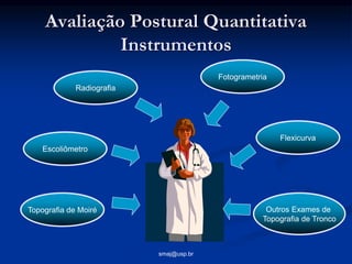 smaj@usp.br
Avaliação Postural Quantitativa
Instrumentos
Flexicurva
Outros Exames de
Topografia de Tronco
Fotogrametria
To...