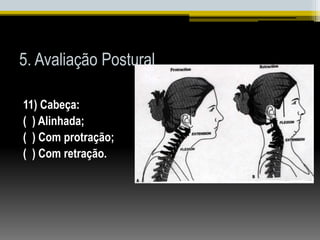 5. Avaliação Postural
11) Cabeça:
( ) Alinhada;
( ) Com protração;
( ) Com retração.
 