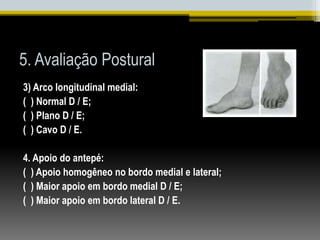 5. Avaliação Postural
3) Arco longitudinal medial:
( ) Normal D / E;
( ) Plano D / E;
( ) Cavo D / E.
4. Apoio do antepé:
( ) Apoio homogêneo no bordo medial e lateral;
( ) Maior apoio em bordo medial D / E;
( ) Maior apoio em bordo lateral D / E.
 
