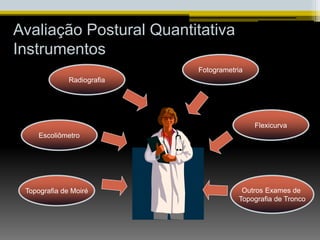 Avaliação Postural Quantitativa
Instrumentos
Flexicurva
Outros Exames de
Topografia de Tronco
Fotogrametria
Topografia de Moiré
Escoliômetro
Radiografia
 