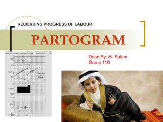 PARTOGRAM
RECORDING PROGRESS OF LABOUR
Done By: Ali Salam
Group 110
 