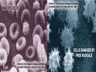 What is a free radical?  Free radicals are produced when our cells create energy and when we are exposed to pollutants or toxins such as cigarette smoke, alcohol or pesticides. If allowed to go unquenched, free radicals can cause damage to the body's cells. The cells that line the arteries, the fat cells in the blood, the immune cells and so on can all be affected by free radicals. And because of this, free radical damage (or oxidation) has been linked to the formation of every degenerative disease known including cancer, cardiovascular disease, cataracts and the ageing process itself. This free radical damage cannot be prevented or cured by any drugs - in fact most drugs are sources of MORE free radicals in the body.   Reference  2005 American Cancer Society  ; D. Harmon, J. Gerontol 