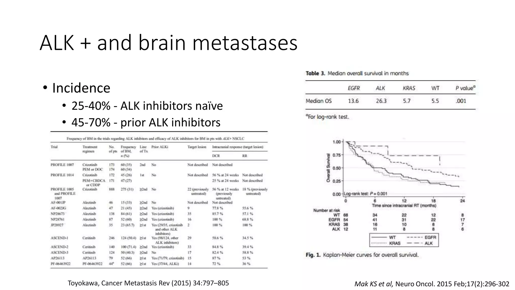 RT for brain metastases in ALK+ NSCLC | PPTX