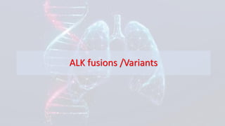 Clinical Integration of NGS for ALK Fusions Identification in NSCLC ...