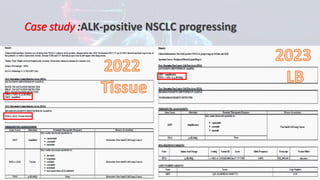 Clinical Integration of NGS for ALK Fusions Identification in NSCLC ...
