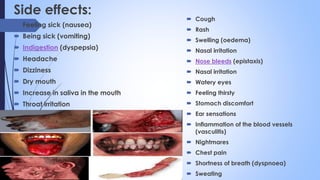 Side effects:
 Feeling sick (nausea)
 Being sick (vomiting)
 Indigestion (dyspepsia)
 Headache
 Dizziness
 Dry mouth
 Increase in saliva in the mouth
 Throat irritation
 Cough
 Rash
 Swelling (oedema)
 Nasal irritation
 Nose bleeds (epistaxis)
 Nasal irritation
 Watery eyes
 Feeling thirsty
 Stomach discomfort
 Ear sensations
 Inflammation of the blood vessels
(vasculitis)
 Nightmares
 Chest pain
 Shortness of breath (dyspnoea)
 Sweating
 