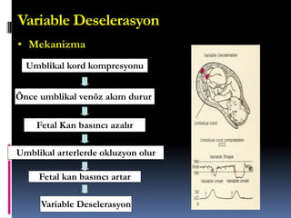 Variable Deselerasyon
Umblikal kord kompresyonu
Önce umblikal venöz akım durur
Fetal Kan basıncı azalır
Umblikal arterlerde okluzyon olur
Variable Deselerasyon
Fetal kan basıncı artar
• Mekanizma
 