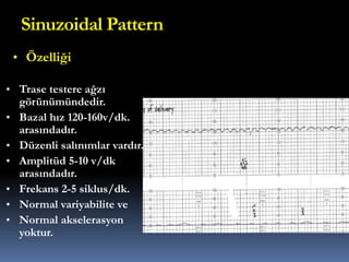 Sinuzoidal Pattern
• Özelliği
• Trase testere ağzı
görünümündedir.
• Bazal hız 120-160v/dk.
arasındadır.
• Düzenli salınımlar vardır.
• Amplitüd 5-10 v/dk
arasındadır.
• Frekans 2-5 siklus/dk.
• Normal variyabilite ve
• Normal akselerasyon
yoktur.
 