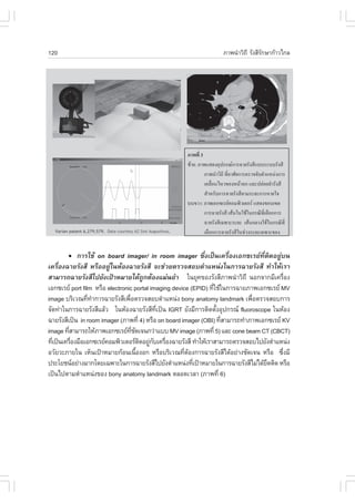 120                                                               ÀÒ¾¹íÒÇÔ¶Õ ÃÑ§ÊÕÃ¡ÉÒ¡ŒÒÇä¡Å
                                                                                   Ñ




       !     ¡ÒÃãªŒ on board imager/ in room imager «Öè§à»š¹à¤Ã×èÍ§àÍ¡«àÃÂ·ÕèµÔ´ÍÂÙ‹º¹
à¤Ã×èÍ§©ÒÂÃÑ§ÊÕ ËÃ×ÍÍÂÙ‹ã¹ËŒÍ§©ÒÂÃÑ§ÊÕ ¨Ðª‹ÇÂµÃÇ¨ÊÍºµíÒáË¹‹§ã¹¡ÒÃ©ÒÂÃÑ§ÊÕ ·íÒãËŒàÃÒ
ÊÒÁÒÃ¶©ÒÂÃÑ§ÊÕä»ÂÑ§à»‡ÒËÁÒÂä´Œ¶Ù¡µŒÍ§áÁ‹¹ÂíÒ ã¹ÂØ¤¢Í§ÃÑ§ÊÕÀÒ¾¹íÒÇÔ¶Õ ¹Í¡¨Ò¡ÁÕà¤Ã×Í§        è
àÍ¡«àÃÂ port film ËÃ×Í electronic portal imaging device (EPID) ·ÕãªŒã¹¡ÒÃ©ÒÂÀÒ¾àÍ¡«àÃÂ MV
                                                                  è
image ºÃÔàÇ³·Õ·Ò¡ÒÃ©ÒÂÃÑ§ÊÕà¾×ÍµÃÇ¨ÊÍºµíÒáË¹‹§ bony anatomy landmark à¾×ÍµÃÇ¨ÊÍº¡ÒÃ
                 è í             è                                             è
¨Ñ´·‹Òã¹¡ÒÃ©ÒÂÃÑ§ÊÕáÅŒÇ ã¹ËŒÍ§©ÒÂÃÑ§ÊÕ·à»š¹ IGRT ÂÑ§ÁÕ¡ÒÃµÔ´µÑ§ÍØ»¡Ã³ fluoroscope ã¹ËŒÍ§
                                               Õè                   é
©ÒÂÃÑ§ÊÕà»š¹ in room imager (ÀÒ¾·Õè 4) ËÃ×Í on board imager (OBI) ·ÕÊÒÁÒÃ¶·íÒÀÒ¾àÍ¡«àÃÂ KV
                                                                      è
image ·ÕÊÒÁÒÃ¶ãËŒÀÒ¾àÍ¡«àÃÂ·ª´à¨¹¡Ç‹Òáºº MV image (ÀÒ¾·Õè 5) áÅÐ cone beam CT (CBCT)
         è                         Õè Ñ
·Õà»š¹à¤Ã×Í§Á×ÍàÍ¡«àÃÂ¤ÍÁ¾ÔÇàµÍÃµ´ÍÂÙ¡ºà¤Ã×Í§©ÒÂÃÑ§ÊÕ ·íÒãËŒàÃÒÊÒÁÒÃ¶µÃÇ¨ÊÍºä»ÂÑ§µíÒáË¹‹§
  è        è                              Ô ‹ Ñ è
ÍÇÑÂÇÐÀÒÂã¹ àËç¹à»‡ÒËÁÒÂ¡ŒÍ¹à¹×Í§Í¡ ËÃ×ÍºÃÔàÇ³·ÕµÍ§¡ÒÃ©ÒÂÃÑ§ÊÕä´ŒÍÂ‹Ò§ªÑ´à¨¹ ËÃ×Í «Ö§ÁÕ
                                        é              è Œ                               è
»ÃÐâÂª¹ÍÂ‹Ò§ÁÒ¡â´Âà©¾ÒÐã¹¡ÒÃ©ÒÂÃÑ§ÊÕä»ÂÑ§µíÒáË¹‹§·Õà»‡ÒËÁÒÂã¹¡ÒÃ©ÒÂÃÑ§ÊÕäÁ‹ä´ŒÂ´µÔ´ ËÃ×Í
                                                           è                       Ö
à»š¹ä»µÒÁµíÒáË¹‹§¢Í§ bony anatomy landmark µÅÍ´àÇÅÒ (ÀÒ¾·Õè 6)
 