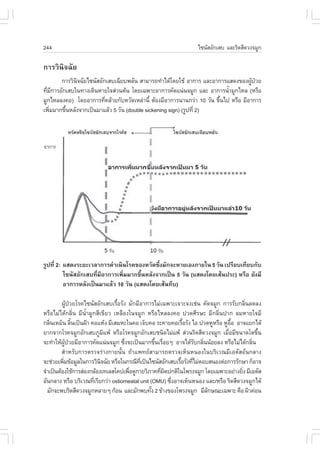 244                                                              ä«¹ÑÊÍÑ¡àÊº áÅÐÃÔ´ÊÕ´Ç§¨ÁÙ¡

¡ÒÃÇÔ¹Ô¨©ÑÂ
       ¡ÒÃÇÔ¹¨©ÑÂä«¹ÑÊÍÑ¡àÊºà©ÕÂº¾ÅÑ¹ ÊÒÁÒÃ¶·íÒä´Œâ´ÂãªŒ ÍÒ¡ÒÃ áÅÐÍÒ¡ÒÃáÊ´§¢Í§¼Ù»ÇÂ
             Ô                                                                      Œ †
·ÕÁ¡ÒÃÍÑ¡àÊºã¹·Ò§à´Ô¹ËÒÂã¨Ê‹Ç¹µŒ¹ â´Âà©¾ÒÐÍÒ¡ÒÃ¤Ñ´á¹‹¹¨ÁÙ¡ áÅÐ ÍÒ¡ÒÃ¹éÒÁÙ¡äËÅ (ËÃ×Í
  è Õ                                                                     í
ÁÙ¡äËÅÅ§¤Í) â´ÂÍÒ¡ÒÃ·Õ¤ÅŒÒÂ¡ÑºËÇÑ´àËÅ‹Ò¹Õé µŒÍ§ÁÕÍÒ¡ÒÃ¹Ò¹¡Ç‹Ò 10 ÇÑ¹ ¢Ö¹ä» ËÃ×Í ÁÕÍÒ¡ÒÃ
                         è                                             é
à¾ÔÁÁÒ¡¢Ö¹ËÅÑ§¨Ò¡à»š¹ÁÒáÅŒÇ 5 ÇÑ¹ (double sickening sign) (ÃÙ»·Õè 2)
    è    é




ÃÙ»·Õè 2: áÊ´§ÃÐÂÐàÇÅÒ¡ÒÃ´íÒà¹Ô¹âÃ¤¢Í§ËÇÑ´«Öè§ÁÑ¡¨ÐËÒÂàÍ§ÀÒÂã¹ 5 ÇÑ¹ à»ÃÕÂºà·ÕÂº¡Ñº
          ä«¹ÑÊÍÑ¡àÊº·ÕèÁÕÍÒ¡ÒÃà¾ÔèÁÁÒ¡¢Öé¹ËÅÑ§¨Ò¡à»š¹ 5 ÇÑ¹ (áÊ´§â´ÂàÊŒ¹»ÃÐ) ËÃ×Í ÂÑ§ÁÕ
          ÍÒ¡ÒÃËÅÑ§à»š¹ÁÒáÅŒÇ 10 ÇÑ¹ (áÊ´§â´ÂàÊŒ¹·Öº)

         ¼ÙŒ»†ÇÂâÃ¤ä«¹ÑÊÍÑ¡àÊºàÃ×éÍÃÑ§ ÁÑ¡ÁÕÍÒ¡ÒÃäÁ‹à©¾ÒÐà¨ÒÐ¨§àª‹¹ ¤Ñ´¨ÁÙ¡ ¡ÒÃÃÑº¡ÅÔè¹Å´Å§
ËÃ×ÍäÁ‹ä´Œ¡ÅÔè¹ ÁÕ¹éíÒÁÙ¡ÊÕà¢ÕÂÇ àËÅ×Í§ã¹¨ÁÙ¡ ËÃ×ÍäËÅÅ§¤Í »Ç´ÈÕÃÉÐ ÁÕ¡ÅÔè¹»Ò¡ ÅÁËÒÂã¨ÁÕ
¡ÅÔ¹àËÁç¹ ÅÔ¹à»š¹½‡Ò ¤ÍáËŒ§ ÁÕàÊÁËÐã¹¤Í à¨çº¤Í ÃÐ¤ÒÂ¤ÍàÃ×ÍÃÑ§ äÍ »Ç´ËÙËÃ×Í ËÙÍÍ ÍÒ¨áÂ¡ä´Œ
    è            é                                          é                   ×é
ÂÒ¡¨Ò¡âÃ¤¨ÁÙ¡ÍÑ¡àÊºÀÙÁá¾Œ ËÃ×ÍâÃ¤¨ÁÙ¡ÍÑ¡àÊºª¹Ô´äÁ‹á¾Œ Ê‹Ç¹ÃÔ´ÊÕ´Ç§¨ÁÙ¡ àÁÕÍÁÕ¢¹Ò´âµ¢Ö¹
                              Ô                                               è           é
¨Ð·íÒãËŒ¼»ÇÂÁÕÍÒ¡ÒÃ¤Ñ´á¹‹¹¨ÁÙ¡ «Ö§¨Ðà»š¹ÁÒ¡¢Ö¹àÃ×ÍÂæ ÍÒ¨ä´ŒÃº¡ÅÔ¹¹ŒÍÂÅ§ ËÃ×ÍäÁ‹ä´Œ¡ÅÔ¹
            ÙŒ †                      è           é è           Ñ è                     è
         ÊíÒËÃÑº¡ÒÃµÃÇ¨Ã‹Ò§¡ÒÂ¹Ñé¹ ¶ŒÒá¾·ÂÊÒÁÒÃ¶µÃÇ¨àËç¹Ë¹Í§ã¹ºÃÔàÇ³ÁÕàÍµÑÊÍÑ¹¡ÅÒ§
¨Ðª‹ÇÂà¾ÔÁ¢ŒÍÁÙÅã¹¡ÒÃÇÔ¹¨©ÑÂ ËÃ×Íã¹¡Ã³Õ·à»š¹ä«¹ÑÊÍÑ¡àÊºàÃ×ÍÃÑ§·ÕäÁ‹µÍºÊ¹Í§µ‹Í¡ÒÃÃÑ¡ÉÒ ¡çÍÒ¨
          è                 Ô               Õè             é è
¨íÒà»š¹µŒÍ§ãªŒ¡ÒÃÊ‹Í§¡ÅŒÍ§à·àÅÊâ¤»à¾×Í´Ù¡ÒÂÇÔÀÒ¤·Õ¼´»¡µÔã¹â¾Ã§¨ÁÙ¡ â´Âà©¾ÒÐÍÂ‹Ò§ÂÔ§ ÁÕàÍµÑÊ
                                        è           è Ô                             è
ÍÑ¹¡ÅÒ§ ËÃ×Í ºÃÔàÇ³·ÕàÃÕÂ¡Ç‹Ò ostiomeatal unit (OMU) «Ö§ÍÒ¨àËç¹Ë¹Í§ áÅÐ/ËÃ×Í ÃÔ´ÊÕ´Ç§¨ÁÙ¡ä´Œ
                        è                               è
  ÁÑ¡¨Ð¾ºÃÔ´ÊÕ´Ç§¨ÁÙ¡ËÅÒÂæ ¡ŒÍ¹ áÅÐÁÑ¡¾º·Ñ§ 2 ¢ŒÒ§¢Í§â¾Ã§¨ÁÙ¡ ÁÕÅ¡É³Ðà©¾ÒÐ ¤×Í ¼ÔÇ¤‹Í¹
                                                é                     Ñ
 