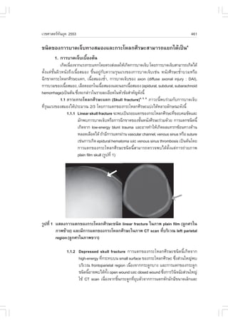 àÇªÈÒÊµÃ·¹ÂØ¤ 2553
          Ñ                                                                                  461

ª¹Ô´¢Í§¡ÒÃºÒ´à¨çº·Ò§ÊÁÍ§áÅÐ¡ÃÐâËÅ¡ÈÕÃÉÐÊÒÁÒÃ¶áÂ¡ä´Œà»š¹4
        1. ¡ÒÃºÒ´à¨çºàº×Í§µŒ¹
                        é
              à¡Ô´à¹×Í§¨Ò¡áÃ§¡ÃÐá·¡â´ÂµÃ§Ê‹§¼ÅãËŒà¡Ô´¡ÒÃºÒ´à¨çº â´Â¡ÒÃºÒ´à¨çºÊÒÁÒÃ¶à¡Ô´ä´Œ
                      è
µÑé§áµ‹ªÑé¹¼ÔÇË¹Ñ§¶Ö§à¹×éÍÊÁÍ§ ¢Öé¹ÍÂÙ‹¡Ñº¤ÇÒÁÃØ¹áÃ§¢Í§¡ÒÃºÒ´à¨çºàª‹¹ Ë¹Ñ§ÈÕÃÉÐªéíÒºÇÁËÃ×Í
©Õ¡¢Ò´¡ÃÐâËÅ¡ÈÕÃÉÐáµ¡, à¹×ÍÊÁÍ§ªéÒ, ¡ÒÃºÒ´à¨çº¢Í§ axon (diffuse axonal injury : DAI),
                                    é        í
¡ÒÃºÇÁ¢Í§à¹×ÍÊÁÍ§, àÅ×Í´ÍÍ¡ã¹à¹×ÍÊÁÍ§áÅÐ¹Í¡à¹×ÍÊÁÍ§ (epidural, subdural, subarachnoid
                  é                       é              é
hemorrhage)à»š¹µŒ¹ «Ö§¨Ð¡Å‹ÒÇã¹ÃÒÂÅÐàÍÕÂ´ã¹ËÑÇ¢ŒÍÊíÒ¤Ñ­´Ñ§¹Õé
                          è
              1.1 ÀÒÇÐ¡ÃÐâËÅ¡ÈÕÃÉÐáµ¡ (Skull fracture)4, 5, 6 ÀÒÇÐ¹Õé¾ºÃ‹ÇÁ¡Ñº¡ÒÃºÒ´à¨çº
·ÕÃ¹áÃ§¢Í§ÊÁÍ§ä´Œ»ÃÐÁÒ³ 2/3 â´Â¡ÒÃáµ¡¢Í§¡ÃÐâËÅ¡ÈÕÃÉÐáº‹§ä´ŒËÅÒÂÅÑ¡É³Ð´Ñ§¹Õé
   èØ
                    1.1.1 Linear skull fracture ¨Ð¾ºà»š¹ÃÍÂáµ¡¢Í§¡ÃÐâËÅ¡ÈÕÃÉÐ·Õ¢Íº¤ÁªÑ´áÅÐ
                                                                                   è
                          ÁÑ¡¾º¡ÒÃºÒ´à¨çºËÃ×Í¡ÒÃ©Õ¡¢Ò´¢Í§ªÑ¹Ë¹Ñ§ÈÕÃÉÐÃ‹ÇÁ´ŒÇÂ ¡ÒÃáµ¡ª¹Ô´¹Õé
                                                              é
                          à¡Ô´¨Ò¡ low-energy blunt trauma áÅÐÍÒ¨·íÒãËŒà¡Ô´¼Åá·Ã¡«ŒÍ¹·Ò§´ŒÒ¹
                          ËÅÍ´àÅ×Í´ä´Œ ¶ŒÒÁÕ¡ÒÃáµ¡¼‹Ò¹ vascular channel, venous sinus ËÃ×Í suture
                          àª‹¹¡ÒÃà¡Ô´ epidural hematoma áÅÐ venous sinus thrombosis à»š¹µŒ¹â´Â
                          ¡ÒÃáµ¡¢Í§¡ÃÐâËÅ¡ÈÕÃÉÐª¹Ô´¹ÕéÊÒÁÒÃ¶µÃÇ¨¾ºä´ŒµÑé§áµ‹¡ÒÃ¶‹ÒÂÀÒ¾
                          plain film skull (ÃÙ»·Õè 1)
                                       Þ

                                                                                Þ

ÃÙ»·Õè 1 áÊ´§¡ÒÃáµ¡¢Í§¡ÃÐâËÅ¡ÈÕÃÉÐª¹Ô´ linear fracture ã¹ÀÒ¾ plain film (ÅÙ¡ÈÃã¹
         ÀÒ¾«ŒÒÂ) áÅÐÁÕ¡ÒÃáµ¡¢Í§¡ÃÐâËÅ¡ÈÕÃÉÐã¹ÀÒ¾ CT scan ·ÕèºÃÔàÇ³ left parietal
         region (ÅÙ¡ÈÃã¹ÀÒ¾¢ÇÒ)

               1.1.2 Depressed skull fracture ¡ÒÃáµ¡¢Í§¡ÃÐâËÅ¡ÈÕÃÉÐª¹Ô´¹Õéà¡Ô´¨Ò¡
                     high-energy ·Õ¡ÃÐ·ºº¹ small surface ¢Í§¡ÃÐâËÅ¡ÈÕÃÉÐ «Ö§Ê‹Ç¹ãË­‹¾º
                                   è                                       è
                     ºÃÔàÇ³ frontoparietal region à¹×Í§¨Ò¡¡ÃÐ´Ù¡ºÒ§ áÅÐ¡ÒÃáµ¡¢Í§¡ÃÐ´Ù¡
                                                     è
                     ª¹Ô´¹ÕÍÒ¨¾ºä´Œ·§ open wound áÅÐ closed wound «Ö§¡ÒÃÇÔ¹¨©ÑÂÊ‹Ç¹ãË­‹
                           é           Ñé                             è      Ô
                     ãªŒ CT scan à¹×Í§¨Ò¡ªÔ¹¡ÃÐ´Ù¡·ÕÂºµÑÇ¨Ò¡¡ÒÃáµ¡ËÑ¡ÁÑ¡ÁÕ¢¹Ò´àÅç¡áÅÐ
                                     è       é         è Ø
 