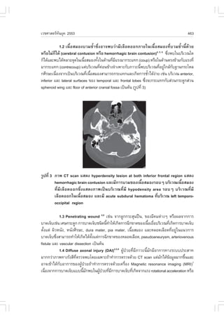àÇªÈÒÊµÃ·¹ÂØ¤ 2553
          Ñ                                                                             463

            1.2 à¹×éÍÊÁÍ§ºÇÁªéíÒ«Öè§ÍÒ¨¾ºÇ‹ÒÁÕàÅ×Í´ÍÍ¡ÀÒÂã¹à¹×éÍÊÁÍ§·ÕèºÇÁªéíÒ¹Õé´ŒÇÂ
ËÃ×ÍäÁ‹¡çä´Œ (cerebral contusion ËÃ×Í hemorrhagic brain contusion)4, 5, 6 «Ö§¾ºã¹ºÃÔàÇ³ã´
                                                                             è
¡çä´ŒáÅÐ¾ºä´ŒËÅÒÂ¨Ø´ã¹à¹×ÍÊÁÍ§·Ñ§ã¹´ŒÒ¹·ÕÁáÃ§ÁÒ¡ÃÐá·¡ (coup) ËÃ×Íã¹´ŒÒ¹µÃ§¢ŒÒÁ¡ÑºáÃ§·Õè
                           é       é         è Õ
ÁÒ¡ÃÐá·¡ (contrecoup) áµ‹ºÃÔàÇ³·Õ¤Í¹¢ŒÒ§¨íÒà¾ÒÐ¡ÑºÀÒÇÐ¹Õ¾ººÃÔàÇ³·ÕÍÂÙã¡ÅŒ¡º°Ò¹¡ÃÐâËÅ
                                     è ‹                       é          è ‹ Ñ
¡ÈÕÃÉÐà¹×Í§¨Ò¡à»š¹ºÃÔàÇ³·Õà¹×ÍÊÁÍ§ÊÒÁÒÃ¶¡ÃÐá·¡áÅÐà¡Ô´¡ÒÃªéÒä´Œ§ÒÂ àª‹¹ ºÃÔàÇ³ anterior,
          è                  è é                                      í ‹
inferior áÅÐ lateral surfaces ¢Í§ temporal áÅÐ frontal lobes «Ö§¨Ð¡ÃÐá·¡¡ÑºÊ‹Ç¹¡ÃÐ´Ù¡Ê‹Ç¹
                                                                    è
sphenoid wing áÅÐ floor of anterior cranial fossa à»š¹µŒ¹ (ÃÙ»·Õè 3)




ÃÙ»·Õè 3 ÀÒ¾ CT scan áÊ´§ hyperdensity lesion at both inferior frontal region áÊ´§
         hemorrhagic brain contusion áÅÐÁÕ¡ÒÃºÇÁ¢Í§à¹×éÍÊÁÍ§ÃÍºæ ºÃÔàÇ³à¹×éÍÊÁÍ§
         ·ÕèÁÕàÅ×Í´ÍÍ¡«Öè§áÊ´§ÀÒ¾à»š¹ºÃÔàÇ³·ÕèÁÕ hypodensity area ÃÍºæ ºÃÔàÇ³·ÕèÁÕ
         àÅ×Í´ÍÍ¡ã¹à¹×éÍÊÁÍ§ áÅÐÁÕ acute subdural hematoma ·ÕºÃÔàÇ³ left temporo-
                                                               è
         occipital region

             1.3 Penetrating wound 4,6 àª‹¹ ¨Ò¡ÅÙ¡¡ÃÐÊØ¹»„¹, ¢Í§ÁÕ¤Áµ‹Ò§æ ËÃ×Í¼Å¨Ò¡¡ÒÃ
ºÒ´à¨çºàª‹¹ àÈÉ¡ÃÐ´Ù¡ ¡ÒÃºÒ´à¨çºª¹Ô´¹Õ·ÒãËŒà¡Ô´¡ÒÃ©Õ¡¢Ò´¢Í§à¹×ÍàÂ×ÍºÃÔàÇ³·Õà¡Ô´¡ÒÃºÒ´à¨çº
                                        é í                          é è           è
µÑé§áµ‹ ¼ÔÇË¹Ñ§, Ë¹Ñ§ÈÕÃÉÐ, dura mater, pia mater, à¹×éÍÊÁÍ§ áÅÐËÅÍ´àÅ×Í´·ÕèÍÂÙ‹ã¹á¹Ç¡ÒÃ
ºÒ´à¨çº«Ö§ÊÒÁÒÃ¶·íÒãËŒà¡Ô´ä´Œµ§áµ‹¡ÒÃ©Õ¡¢Ò´¢Í§ËÅÍ´àÅ×Í´, pseudoaneurysm, arteriovenous
           è                    Ñé
fistula áÅÐ vascular dissection à»š¹µŒ¹
             1.4 Diffuse axonal injury (DAI)4,5,6 ¼ÙŒ»†ÇÂ·ÕèÁÕÀÒÇÐ¹ÕéÁÑ¡ÁÕÍÒ¡ÒÃ·Ò§ÃÐºº»ÃÐÊÒ·
ÁÒ¡¡Ç‹ÒÀÒ¾·Ò§ÃÑ§ÊÕ·µÃÇ¨¾ºâ´Âà©¾ÒÐ¶ŒÒ·íÒ¡ÒÃµÃÇ¨´ŒÇÂ CT scan áµ‹Á¡ä´Œ¢ÍÁÙÅÁÒ¡¢Ö¹áÅÐ
                       Õè                                                    Ñ   Œ      é
ÍÒ¨à¢ŒÒä´Œ¡ÑºÍÒ¡ÒÃ¢Í§¼ÙŒ»†ÇÂ¶ŒÒ·íÒ¡ÒÃµÃÇ¨´ŒÇÂà¤Ã×èÍ§ Magnetic resonance imaging (MRI)7
à¹×Í§¨Ò¡¡ÒÃºÒ´à¨çºáºº¹ÕÁ¡¾ºã¹¼Ù»ÇÂ·ÕÁ¡ÒÃºÒ´à¨çº·Õà¡Ô´¨Ò¡áÃ§ rotational acceleration ËÃ×Í
    è                      é Ñ      Œ † è Õ               è
 