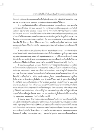 474                                     ÀÒ¾ÇÔ¹Ô¨©ÑÂã¹¼ÙŒ»†ÇÂ·Õèä´ŒÃÑººÒ´à¨çººÃÔàÇ³ËÅÍ´àÅ×Í´á´§¨Ò¡ÍØºÑµÔàËµØ

à»š¹¡Ðà»ÃÒÐ ÅŒÍÁÃÍº´ŒÇÂ adventitia ËÃ×Í à¹×ÍàÂ×Í¢ŒÒ§à¤ÕÂ§ áÅÐ¨ÐÁÕÊÇ¹·ÕµÍ¡ÑºµÑÇËÅÍ´àÅ×Í´ ÀÒ¾
                                                      é è                              ‹ è ‹
MIP áÅÐ 3D VR ¨ÐáÊ´§µíÒáË¹‹§áÅÐ¢Íºà¢µ¢Í§ pseudoaneurysm ä´Œª´à¨¹                                Ñ
               3. ¡ÒÃÍØ´µÑ¹ (occlusion) ¤×Í ¡ÒÃäÁ‹¾º contrast media ã¹ËÅÍ´àÅ×Í´á´§ â´ÂÍÒ¨¾ºà»š¹
ÃÍÂâÃ¤¢¹Ò´àÅç¡ (focal ËÃ×Í short segment) ËÃ×Í ÃÍÂâÃ¤¢¹Ò´ãË­‹ (long segment) â´Â¶ŒÒà¡Ô´ÁÕ
occlusion ÍÂÙ¹Ò¹ ¨Ð¾º collateral vessels Ã‹ÇÁ´ŒÇÂ ¡ÒÃ´ÙµÒáË¹‹§·ÕÁ¡ÒÃÍØ´µÑ¹¢Í§ËÅÍ´àÅ×Í´
                        ‹                                                        í          è Õ
¨Ò¡ÀÒ¾ axial ÍÂ‹Ò§à´ÕÂÇ ÍÒ¨·íÒãËŒäÁ‹àËç¹¤ÇÒÁ¼Ô´»¡µÔ·à»š¹ focal ËÃ×Í short segment occlusion
                                                                      Õè
ä´Œ á¹Ð¹íÒãËŒãªŒÀÒ¾ coronal MIP ËÃ×Í coronal 3D VR Ã‹ÇÁ´ŒÇÂ (ÃÙ»·Õè 1) ¢ŒÍÁÙÅ·Õä´Œ¨Ò¡ÀÒ¾ CTA                  è
¹Ñ¹ ¹Í¡¨Ò¡¡ÒÃºÍ¡µíÒáË¹‹§¢Í§¡ÒÃÍØ´µÑ¹áÅŒÇ ÂÑ§ÊÒÁÒÃ¶ºÍ¡ distal run off ¢Í§ËÅÍ´àÅ×Í´Ê‹Ç¹
  é
»ÅÒÂ¹Ñé¹æä´Œ ÁÕ»ÃÐâÂª¹ã¹¡ÒÃãªŒÇÒ§á¼¹¡ÒÃÃÑ¡ÉÒ ÃÇÁ¶Ö§¡ÒÃ»ÃÐàÁÔ¹µíÒáË¹‹§¢Í§ distal
anastomosis ã¹ÃÒÂ·ÕµÍ§·íÒ¡ÒÃ¼‹ÒµÑ´ bypass graft ¤Ã‹ÍÁ¼‹Ò¹µíÒáË¹‹§¢Í§ËÅÍ´àÅ×Í´á´§·ÕÁÕ
                                   è Œ                                                                                          è
¡ÒÃÍØ´µÑ¹
               4. Dissection ¾ºà»š¹ eccentric stenosis ¢Í§µÑÇËÅÍ´àÅ×Í´á´§ à¡Ô´¨Ò¡¡ÒÃ©Õ¡¢Ò´
¢Í§¼¹Ñ§ËÅÍ´àÅ×Í´ªÑ¹ intima â´Â¾ºà»š¹ÅÑ¡É³Ð¨Ñ¹·ÃàÊÕÂÇã¹ÀÒ¾µÑ´¢ÇÒ§ (ÃÙ»·Õè 3) ÍÒ¨¾º intimal
                              é                                   é
flap (intraluminal linear filling defect) ËÃ×Í segmental thrombus ã¹ÃÒÂ·ÕÁ¡ÒÃºÒ´à¨çº¢Í§ªÑ¹ intima
                                                                                           è Õ                        é
à¾ÕÂ§àÅç¡¹ŒÍÂ ÍÒ¨¾ºà¾ÕÂ§ÅÑ¡É³Ð¢Í§ irregular lumen ¢Í§ËÅÍ´àÅ×Í´ºÃÔàÇ³¹Ñ¹æ «Ö§µŒÍ§ãªŒ¤ÇÒÁ                  é      è
ÅÐàÍÕÂ´ã¹¡ÒÃÇÔ¹¨©ÑÂ µŒÍ§ãªŒ axial image Ã‹ÇÁ¡Ñº saggital MPR áÅÐ coronal MPR Ã‹ÇÁ´ŒÇÂ
                          Ô
               5. Arteriovenous fistula formation à¡Ô´¨Ò¡¡ÒÃ©Õ¡¢Ò´¢Í§ËÅÍ´àÅ×Í´á´§áÅÐËÅÍ´àÅ×Í´
´íÒ·ÕÍÂÙª´¡Ñ¹·íÒãËŒà¡Ô´ÃÙÃÇàª×ÍÁµ‹Í¡Ñ¹ ¡ÒÃÇÔ¹¨©ÑÂÀÒÇÐ AV fistula ¹Ñ¹ ¨ÐµŒÍ§áÊ´§µíÒáË¹‹§·Õè artery
          è ‹ Ô                        Ñè è             Ô                            é
µ‹Í¡Ñº vein áÅÐ¢¹Ò´¢Í§ fistular site à¾×ÍãªŒÇÒ§á¼¹¡ÒÃÃÑ¡ÉÒ â´Â¡ÒÃ»´ÃÙÃÇ¹Ñ¹ ÅÑ¡É³Ð·Õ¾º
                                                   è                                                       Ñè é             è
¨Ò¡ CTA ¤×Í ¡ÒÃ¾º contrast ã¹ËÅÍ´àÅ×Í´´íÒµÑ§áµ‹ã¹ arterial phase â´ÂËÅÍ´àÅ×Í´´íÒºÃÔàÇ³
                                                                é
¹Ñ¹æ ÁÑ¡ÁÕ¢¹Ò´ãË­‹¢¹´ŒÇÂ Ã‹ÇÁ¡Ñº¡ÒÃ¾ºµíÒáË¹‹§¢Í§ÃÙÃÇÃÐËÇ‹Ò§ËÅÍ´àÅ×Í´á´§áÅÐ´íÒ (ÃÙ»·Õè 4)
    é                           Öé                                       Ñè
¢ŒÍÊÑ§à¡µã¹¡ÒÃËÒµíÒáË¹‹§¢Í§ÃÙÃÇ¹Ñ¹ ¤×Í ¡ÒÃËÒµíÒáË¹‹§·ÕàÃÔÁ¾º early fill vein Â¡µÑÇÍÂ‹Ò§ã¹ÃÙ»
                                            Ñè é                            è è
·Õè 4 ¨ÐàÃÔÁ¾º contrast ã¹ËÅÍ´àÅ×Í´´íÒ·ÕµÒáË¹‹§¢Í§ popliteal vein (äÅ‹¢¹ä»µÒÁ superficial
                è                                    è í                                              Öé
femoral vein, iliac vein ¨¹¶Ö§ inferior vena cava) ¨Ò¡¹Ñ¹ãªŒÀÒ¾ axial äÅ‹´ºÃÔàÇ³ÃÍºà¢‹Òà¾×ÍËÒ
                                                                    é                               Ù                     è
µíÒáË¹‹§·ÕËÅÍ´àÅ×Í´á´§©Õ¡¢Ò´ Ã‹ÇÁ¡Ñº¡ÒÃãªŒÀÒ¾ saggital MPR áÅÐ coronal MPR ¨Ð¾ºµíÒáË¹‹§
                  è
ÃÙÃÇä´Œ§ÒÂ¢Ö¹ áÅÐãªŒàÇÅÒ¹ŒÍÂÅ§ áµ‹ã¹ÃÒÂ·ÕÁÃÃÇËÅÒÂµíÒáË¹‹§¡ç¨Ð´ÙÂÒ¡¢Ö¹ áÅÐã¹¼Ù»ÇÂ·ÕÁàÈÉ
      Ñè ‹ é                                           è Õ Ù Ñè                                   é               Œ † è Õ
¡ÃÐÊØ¹ËÃ×ÍâÅËÐàËÅ×ÍÍÂÙ‹ ¨ÐÁÕ streak artifact Ãº¡Ç¹¡ÒÃËÒµíÒáË¹‹§ÃÙÃÇ «Ö§ÍÒ¨µŒÍ§ãªŒ¡ÒÃµÃÇ¨Í×¹æ
                                                                                        Ñè è                                  è
àª‹¹ conventional angiography Ã‹ÇÁ»ÃÐàÁÔ¹à»š¹ÃÒÂæä»
               6. Arterial spasm à»š¹¡ÒÃË´à¡Ãç§¢Í§ËÅÍ´àÅ×Í´á´§ «Ö§à¡Ô´¨Ò¡¡ÒÃºÒ´à¨çº¢Í§à¹×ÍàÂ×Í
                                                                                   è                                     é è
ÃÍºæ «Ö§·íÒãËŒ¤ÅíÒªÕ¾¨ÃºÃÔàÇ³Ê‹Ç¹»ÅÒÂäÁ‹ä´ŒËÃ×Íä´ŒàºÒ ·íÒãËŒÊ§ÊÑÂÇ‹ÒÁÕ¡ÒÃºÒ´à¨çº¢Í§ËÅÍ´àÅ×Í´
             è
à¡Ô´¢Ö¹ ã¹¼Ù»ÇÂ¡ÅØÁ¹Õ¡ÒÃµÃÇ¨â´Â CTA ¨ÐÁÕ»ÃÐâÂª¹ã¹á§‹·ºÍ¡ÃÍÂâÃ¤Ç‹Òà»š¹ÃÍÂâÃ¤·ÕäÁ‹Ã¹áÃ§
           é        Œ †     ‹ é                                               Õè                                     è Ø
äÁ‹µÍ§ÃÑº¡ÒÃ¼‹ÒµÑ´ áÅÐ¡ÒÃµÃÇ¨äÁ‹ invasive ¡ÒÃË´à¡Ãç§¢Í§ËÅÍ´àÅ×Í´¨Ðà»š¹áººªÑÇ¤ÃÒÇ áÅÐ
        Œ                                                                                                          è
ÊÒÁÒÃ¶¡ÅÑºÁÒà»š¹»¡µÔä´Œ ÅÑ¡É³Ð·Õ¾º¨Ò¡ CTA à»š¹ concentric smooth narrowing ¢Í§ËÅÍ´
                                                 è
àÅ×Í´á´§ºÃÔàÇ³¹Ñé¹æ ã¹ÀÒ¾ axial ¨Ð¾ºÇ‹Ò ¢¹Ò´àÊŒ¹¼‹ÒÈÙ¹Â¡ÅÒ§¢Í§ËÅÍ´àÅ×Í´á´§ÁÕ¢¹Ò´
 