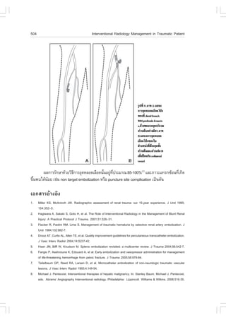 504                                            Interventional Radiology Management in Traumatic Patient




      ¼Å¡ÒÃÃÑ¡ÉÒ´ŒÇÂÇÔ¸¡ÒÃÍØ´ËÅÍ´àÅ×Í´¹Ñ¹ÍÂÙ·»ÃÐÁÒ³ 85-100%(7) áÅÐÀÒÇÐá·Ã¡«ŒÍ¹·Õà¡Ô´
                         Õ                é ‹ Õè                                 è
¢Ö¹¾ºä´Œ¹ÍÂ àª‹¹ non target embolization ËÃ×Í puncture site complication à»š¹µŒ¹
  é      Œ

àÍ¡ÊÒÃÍŒÒ§ÍÔ§
1.    Miller KS, McAninch JW. Radiographic assessment of renal trauma: our 15-year experience. J Urol 1995;
      154:352–5.
2.    Hagiwara A, Sakaki S, Goto H, et al. The Role of Interventional Radiology in the Management of Blunt Renal
      Injury: A Practical Protocol J Trauma. 2001;51:526–31.
3.    .lacker R, Paolini RM, Lima S. Management of traumatic hematuria by selective renal artery embolization. J
      Urol 1984;132:662-7.
4.    Drooz AT, Curtis AL, Allen TE, et al. Quality improvement guidelines for percutaneous transcatheter embolization.
      J Vasc Interv Radiol 2004;14:S237-42.
5.    Haan JM, Biffl W, Knudson M. Splenic embolization revisited: a multicenter review. J Trauma 2004;56:542-7.
6.    .angio P, Asehnoune K, Edouard A, et al. Early embolization and vasopressor administration for management
      of life-threatening hemorrhage from pelvic fracture. J Trauma 2005;58:978-84.
7.    Teitelbaum GP, Reed RA, Larsen D, et al. Microcatheter embolization of non-neurologic traumatic vascular
      lesions. J Vasc Interv Radiol 1993;4:149-54.
8.    Michael J. Pentecost. Interventional therapies of hepatic malignancy. In: Stanley Baum, Michael J. Pentecost,
      eds. Abrams’ Angiography Interventional radiology. Philadelphia: Lippincott Williams & Wilkins, 2006:516-35.
 