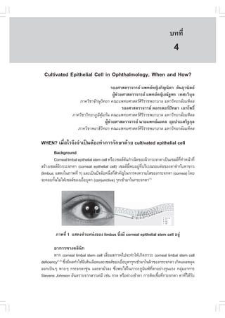 àÇªÈÒÊµÃ·¹ÂØ¤ 2553
          Ñ                                                                    º··Õè        35

                                                                                  4
 Cultivated Epithelial Cell in Ophthalmology, When and How?
                                                ÃÍ§ÈÒÊµÃÒ¨ÒÃÂ á¾·ÂË­Ô§ÀÔ­¹ÔµÒ µÑ¹¸ØÇ¹ÔµÂ
                                                 ¼ÙŒª‹ÇÂÈÒÊµÃÒ¨ÒÃÂ á¾·ÂË­Ô§³Ñ°¾Ã à·ÈÐÇÔºØÅ
                      ÀÒ¤ÇÔªÒ¨Ñ¡ÉØÇ·ÂÒ ¤³Ðá¾·ÂÈÒÊµÃÈÃÃÒª¾ÂÒºÒÅ ÁËÒÇÔ·ÂÒÅÑÂÁËÔ´Å
                                         Ô                       ÔÔ
                                                        ÃÍ§ÈÒÊµÃÒ¨ÒÃÂ ´Í¡àµÍÃ»˜·ÁÒ àÍ¡â¾¸Ôì
                   ÀÒ¤ÇÔªÒÇÔ·ÂÒÀÙÁ¤Á¡Ñ¹ ¤³Ðá¾·ÂÈÒÊµÃÈÃÃÒª¾ÂÒºÒÅ ÁËÒÇÔ·ÂÒÅÑÂÁËÔ´Å
                                  Ô ØŒ                           ÔÔ
                                           ¼ÙŒª‹ÇÂÈÒÊµÃÒ¨ÒÃÂ ¹ÒÂá¾·ÂÁ§¤Å ÍØÂ»ÃÐàÊÃÔ°¡ØÅ
                     ÀÒ¤ÇÔªÒ¾ÂÒ¸ÔÇ·ÂÒ ¤³Ðá¾·ÂÈÒÊµÃÈÃÃÒª¾ÂÒºÒÅ ÁËÒÇÔ·ÂÒÅÑÂÁËÔ´Å
                                       Ô                         ÔÔ

WHEN? àÁ×èÍäÃ¨Ö§¨íÒà»š¹µŒÍ§·íÒ¡ÒÃÃÑ¡ÉÒ´ŒÇÂ cultivated epithelial cell
       Background
        Corneal limbal epithelial stem cell ËÃ×Í à«ÅÅµ¹¡íÒà¹Ô´¢Í§¼ÔÇ¡ÃÐ¨¡µÒà»š¹à«ÅÅ··ÒË¹ŒÒ·Õè
                                                       Œ                              Õè í
ÊÃŒÒ§à«ÅÅ¼Ç¡ÃÐ¨¡µÒ (corneal epithelial cell) à«ÅÅ¹¾ºÍÂÙ·ºÃÔàÇ³ÃÍÂµ‹Í¢Í§µÒ´íÒ¡ÑºµÒ¢ÒÇ
           Ô                                             Õé    ‹ Õè
(limbus; áÊ´§ã¹ÀÒ¾·Õè 1) áÅÐà»š¹»˜¨¨ÑÂË¹Ö§·ÕÊÒ¤Ñ­ã¹¡ÒÃ¤§¤ÇÒÁãÊ¢Í§¡ÃÐ¨¡µÒ (cornea) â´Â
                                             è èí
¨Ð¤ÍÂ¡Ñ¹äÁ‹ãËŒà«ÅÅ¢Í§àÂ×ÍºØµÒ (conjunctiva) ÃØ¡à¢ŒÒÁÒã¹¡ÃÐ¨¡µÒ(1)
        é                  è




         ÀÒ¾·Õè 1 áÊ´§µíÒáË¹‹§¢Í§ limbus «Öè§ÁÕ corneal epithelial stem cell ÍÂÙ‹

       ÍÒ¡ÒÃ·Ò§¤ÅÔ¹¡
                   Ô
        ËÒ¡ corneal limbal stem cell àÊ×ÍÁÊÀÒ¾ä»¨Ð·íÒãËŒà¡Ô´ÀÒÇÐ corneal limbal stem cell
                                            è
deficiency(1,2) «Ö§ÁÕ¼Å·íÒãËŒÁàÊŒ¹àÅ×Í´áÅÐà«ÅÅ¢Í§àÂ×ÍºØµÒÃØ¡à¢ŒÒÁÒã¹¼ÔÇ¢Í§¡ÃÐ¨¡µÒ à¡Ô´á¼ÅËÅØ´
                  è           Õ                      è
ÅÍ¡à»š¹æ ËÒÂæ ¡ÃÐ¨¡µÒ¢Ø¹ áÅÐµÒÁÑÇÅ§ «Ö§¾ºä´Œã¹ÀÒÇÐÀÙÁá¾Œ·µÒÍÂ‹Ò§ÃØ¹áÃ§ ¡ÅØÁÍÒ¡ÒÃ
                                ‹               è                  Ô Õè                 ‹
Stevens Johnson ÍÑ¹µÃÒÂ¨Ò¡ÊÒÃà¤ÁÕ àª‹¹ ¡Ã´ ËÃ×Í´‹Ò§à¢ŒÒµÒ ¡ÒÃµÔ´àª×Í·Õ¡ÃÐ¨¡µÒ µÒ·Õä´ŒÃº
                                                                          é è             è Ñ
 