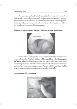 àÇªÈÒÊµÃ·¹ÂØ¤ 2553
          Ñ                                                                               599

         à¡Ô´¡ÒÃÍØ´µÑ¹¢Í§µ‹ÍÁ·ÕèÍÂÙ‹ºÃÔàÇ³ªÑé¹¼ÔÇ¢Í§ÊÒÂàÊÕÂ§ â´ÂÊÒàËµØÍÒ¨à¡Ô´¨Ò¡¡ÒÃµÐâ¡¹
ãªŒàÊÕÂ§ÁÒ¡áÅŒÇ·íÒãËŒà¡Ô´¾Ñ§¼×´·ÕÃà»´¢Í§µ‹ÍÁ·ÕÊÃŒÒ§àÁ×Í¡ (mucous) ºÃÔàÇ³ÊÒÂàÊÕÂ§·íÒãËŒà¡Ô´¡ÒÃ
                                 èÙ            è
ÍØ´µÑ¹¢Í§µ‹ÍÁáÅŒÇà¡Ô´à»š¹¶Ø§¹éÒµÒÁÁÒ ã¹ºÒ§ÃÒÂ¶Ø§¹éÒÍÒ¨áµ¡àÍ§ä´Œ áµ‹ºÒ§ÃÒÂ¡ç¤§ÍÂÙÍÂ‹Ò§¹Ñ¹
                               í                      í                               ‹      é
·íÒãËŒà¡Ô´ÍÒ¡ÒÃàÊÕÂ§áËºµÅÍ´àÇÅÒ ¡ÒÃÃÑ¡ÉÒâ´Â¡ÒÃ¼‹ÒµÑ´àÍÒ¶Ø§¹éÒÍÍ¡(excision) ËÃ×Íà»´·Ò§
                                                                   í
ãËŒ¹Òã¹¶Ø§¹éÒÊÒÁÒÃ¶ÃÐºÒÂÍÍ¡ÁÒä´Œ (marsupialization)
     éí      í

Bilateral diffuse polyposis (Reinke’s edema or smoker’s polyposis)




       ÁÕ¡ÒÃºÇÁã¹ªÑ¹ãµŒàÂ×ÍºØ¼Ç (Reinke’s space) ·ÑÇæä»·ÕÊÒÂàÊÕÂ§·Ñ§ 2 ¢ŒÒ§ ÁÑ¡¨Ðà¡Ô´¨Ò¡
                    é     è Ô                           è   è        é
¡ÒÃÃÐ¤ÒÂà¤×Í§¨Ò¡¤ÇÑ¹ºØËÃÕÃÇÁ¡ÑºÁÕ¡ÒÃãªŒàÊÕÂ§ÁÒ¡ ¼Ù»ÇÂ¨Ð¾Ù´ÁÕàÊÕÂ§µèÒ¡Ç‹Ò»¡µÔ (lower pitch)
                         è‹                       Œ †              í
áÅÐäÁ‹ÊÒÁÒÃ¶¢Öé¹àÊÕÂ§ÊÙ§ä´ŒàËÁ×Í¹à´ÔÁ µÃÇ¨´Ù¨Ð¾ºÊÒÂàÊÕÂ§ºÇÁ¹éíÒµÅÍ´á¹Ç¢Í§ÊÒÂàÊÕÂ§
ÍÒ¨µŒÍ§à¨ÒÐ´ÙÃÐ´ÑºÎÍÃâÁ¹ä·ÃÍÂ´´ŒÇÂã¹¡Ã³Õ·ÕèÊ§ÊÑÂÃÐ´ÑºÎÍÃâÁ¹µèíÒà¹×èÍ§¨Ò¡·íÒãËŒÊÒÂàÊÕÂ§
ºÇÁä´Œàª‹¹¡Ñ¹ ¡ÒÃÃÑ¡ÉÒâ´Â¡ÒÃãËŒ¼»ÇÂËÂØ´ÊÙºººØËÃÕáÅÐ¾Ñ¡¡ÒÃãªŒàÊÕÂ§ ã¹ÃÒÂ·ÕÍÒ¡ÒÃäÁ‹´¢¹
                                  ÙŒ †                è                     è          Õ Öé
ÍÒ¨·íÒ¡ÒÃ¼‹ÒµÑ´â´Â¡ÒÃÅÍ¡àÍÒÊ‹Ç¹¼ÔÇ·ÕºÇÁÍÍ¡ºÒ§Ê‹Ç¹à¾×Í·íÒãËŒàÊÕÂ§´Õ¢¹
                                       è                  è            Öé

Contact ulcer ËÃ×Í Granuloma
 