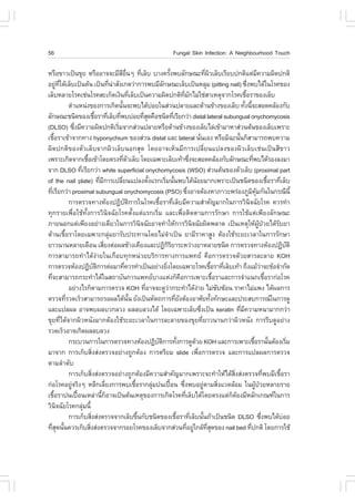 56                                                                                                        .ungal Skin Infection: A Neighbourhood Touch

ËÃ×Í¢ÒÇà»š¹¢ØÂ ËÃ×ÍÍÒ¨¨ÐÁÕÊÍ¹æ ·ÕàÅçº ºÒ§¤ÃÑ§¾ºÅÑ¡É³Ð·Õ¼ÇàÅçºàÃÕÂº»¡µÔáµ‹Á¤ÇÒÁ¼Ô´»¡µÔ
                                                      Õ ×è                 è                     é                                           è Ô                                    Õ
ÍÂÙ·ãµŒàÅçºà»š¹µŒ¹ à»š¹·Õ¹ÒÊÑ§à¡µÇ‹Ò¡ÒÃ¾ºÁÕÅ¡É³ÐàÅçºà»š¹ËÅØÁ (pitting nail) «Ö§¾ºä´Œã¹âÃ¤¢Í§
          ‹ Õè                                  è ‹                                       Ñ                                                                              è
àÅçºËÅÒÂâÃ¤àª‹¹âÃ¤ÊÐà¡ç´à§Ô¹·ÕàÅçºà»š¹¤ÇÒÁ¼Ô´»¡µÔ·Á¡äÁ‹ãª‹ÊÒàËµØ¨Ò¡âÃ¤àª×ÍÃÒ¢Í§àÅçº
                                                                   è                                              Õè Ñ                                                 é
                 µíÒáË¹‹§¢Í§¡ÒÃà¡Ô´¹Ñ¹¨Ð¾ºä´ŒºÍÂã¹Ê‹Ç¹»ÅÒÂáÅÐ´ŒÒ¹¢ŒÒ§¢Í§àÅçº ·Ñ§¹Õ¨ÐÊÍ´¤ÅŒÍ§¡Ñº
                                                       é                          ‹                                                                                   é é
ÅÑ¡É³Ðª¹Ô´¢Í§àª×ÍÃÒ·ÕàÅçº·Õ¾ºº‹ÍÂ·ÕÊ´¤×Íª¹Ô´·ÕàÃÕÂ¡Ç‹Ò distal lateral subungual onychomycosis
                                     é è è                                   èØ                        è
(DLSO) «Ö§ÁÕ¤ÇÒÁ¼Ô´»¡µÔàÃÔÁ¨Ò¡Ê‹Ç¹»ÅÒÂËÃ×Í´ŒÒ¹¢ŒÒ§¢Í§àÅçºäÅ‹à¢ŒÒÁÒËÒÊ‹Ç¹µŒ¹¢Í§àÅçºà¾ÃÒÐ
                    è                               è
àª×ÍÃÒà¢ŒÒ¨Ò¡·Ò§ hyponychium ¢Í§Ê‹Ç¹ distal áÅÐ lateral ¹Ñ¹àÍ§ ËÃ×ÍÁÔ©Ð¹Ñ¹¡çÊÒÁÒÃ¶¾º¤ÇÒÁ
      é                                                                                                                              è                          é
¼Ô´»¡µÔ¢Í§µÑÇàÅçº¨Ò¡¼ÔÇàÅçº¹Í¡ÊØ´ â´ÂÍÒ¨àËç¹ÁÕ¡ÒÃà»ÅÕèÂ¹á»Å§¢Í§¼ÔÇàÅçºàª‹¹à»š¹ÊÕ¢ÒÇ
à¾ÃÒÐà¡Ô´¨Ò¡àª×Íà¢ŒÒâ´ÂµÃ§·ÕµÇàÅçº â´Âà©¾ÒÐàÅçºà·ŒÒ«Ö§¨ÐÊÍ´¤ÅŒÍ§¡ÑºÅÑ¡É³Ð·Õ¾ºä´ŒÃÍ§Å§ÁÒ
                            é                              è Ñ                                                           è                                                      è
¨Ò¡ DLSO ·ÕàÃÕÂ¡Ç‹Ò white superficial onychomycosis (WSO) Ê‹Ç¹µŒ¹¢Í§µÑÇàÅçº (proximal part
                        è
of the nail plate) ·ÕÁ¡ÒÃà»ÅÕÂ¹á»Å§µÑ§áÃ¡àÃÔÁ¹Ñ¹¾ºä´Œ¹ÍÂÁÒ¡à¾ÃÒÐà»š¹ª¹Ô´¢Í§àª×ÍÃÒ·ÕàÅçº
                                        è Õ              è                      é           è é                                  Œ                                                              é     è
·ÕàÃÕÂ¡Ç‹Ò proximal subungual onychomycosis (PSO) «Ö§ÍÒ¨µŒÍ§ËÒÀÒÇÐ¾Ã‹Í§ÀÙÁ¤Á¡Ñ¹ã¹¡Ã³Õ¹Õé
  è                                                                                                                    è                                                       Ô ØŒ
                 ¡ÒÃµÃÇ¨·Ò§ËŒÍ§»¯Ôºµ¡ÒÃã¹âÃ¤àª×ÍÃÒ·ÕàÅçºÁÕ¤ÇÒÁÊíÒ¤Ñ­ÁÒ¡ã¹¡ÒÃÇÔ¹¨©ÑÂâÃ¤ ¤ÇÃ·íÒ
                                                              Ñ Ô                      é             è                                                                     Ô
·Ø¡ÃÒÂà¾×èÍãªŒ·Ñé§¡ÒÃÇÔ¹Ô¨©ÑÂâÃ¤µÑé§áµ‹áÃ¡àÃÔèÁ áÅÐà¾×èÍµÔ´µÒÁ¡ÒÃÃÑ¡ÉÒ ¡ÒÃãªŒáµ‹à¾ÕÂ§ÅÑ¡É³Ð
ÀÒÂ¹Í¡áµ‹à¾ÕÂ§ÍÂ‹Ò§à´ÕÂÇã¹¡ÒÃÇÔ¹¨©ÑÂÍÒ¨·íÒãËŒ¡ÒÃÇÔ¹¨©ÑÂ¼Ô´¾ÅÒ´ à»š¹àËµØãËŒ¼»ÇÂä´ŒÃºÂÒ
                                                                         Ô                                                   Ô                                                        ÙŒ †        Ñ
µŒÒ¹àª×éÍÃÒâ´Âà©¾ÒÐ¡ÅØ‹ÁÂÒÃÑº»ÃÐ·Ò¹â´ÂäÁ‹¨íÒà»š¹ ÂÒÁÕÃÒ¤ÒÊÙ§ µŒÍ§ãªŒÃÐÂÐàÇÅÒã¹¡ÒÃÃÑ¡ÉÒ
ÂÒÇ¹Ò¹ËÅÒÂà´×Í¹ àÊÕÂ§µ‹Í¼Å¢ŒÒ§à¤ÕÂ§áÅÐ»¯Ô¡ÃÂÒÃÐËÇ‹Ò§ÂÒËÅÒÂª¹Ô´ ¡ÒÃµÃÇ¨·Ò§ËŒÍ§»¯ÔºµÔ
                                            è                                                  ÔÔ                                                                                                         Ñ
¡ÒÃÊÒÁÒÃ¶·íÒä´Œ§‹ÒÂã¹à¡×Íº·Ø¡Ë¹‹ÇÂºÃÔ¡ÒÃ·Ò§¡ÒÃá¾·Â ¤×Í¡ÒÃµÃÇ¨´ŒÇÂÊÒÃÅÐÅÒÂ KOH
¡ÒÃµÃÇ¨ËŒÍ§»¯Ôºµ¡ÒÃµ‹ÍÁÒ·Õ¤ÇÃ·íÒà»š¹ÍÂ‹Ò§ÂÔ§â´Âà©¾ÒÐâÃ¤àª×ÍÃÒ·ÕàÅçºà·ŒÒ ¶Ö§áÁŒÇÒ¨Ð¢ŒÍ¨íÒ¡Ñ´
                                    Ñ Ô                     è                                è                                                      é è                                 ‹
·Õ¨ÐÊÒÁÒÃ¶¡ÃÐ·íÒä´Œã¹Ê¶ÒºÑ¹¡ÒÃá¾·ÂºÒ§áË‹§¡ç¤Í¡ÒÃà¾ÒÐàª×ÍÃÒáÅÐ¡ÒÃ¨íÒá¹¡àª×ÍÃÒ¡‹ÍâÃ¤
    è                                                                                                         ×                                      é                                        é
                 ÍÂ‹Ò§äÃ¡çµÒÁ¡ÒÃµÃÇ¨ KOH ·ÕÍÒ¨¨Ð´ÙÇÒ¡ÃÐ·íÒä´Œ§ÒÂ äÁ‹«º«ŒÍ¹ ÃÒ¤ÒäÁ‹á¾§ ä´Œ¼Å¡ÒÃ
                                                                             è                 ‹                                   ‹                   Ñ
µÃÇ¨·ÕÃÇ´àÃçÇÊÒÁÒÃ¶ÃÍ¼Åä´Œ¹¹ ÂÑ§à»š¹ËÑµ¶¡ÒÃ·ÕÂ§µŒÍ§ÍÒÈÑÂ·Ñ§·Ñ¡ÉÐáÅÐ»ÃÐÊº¡ÒÃ³ã¹¡ÒÃ´Ù
               è                                                Ñé                                       è Ñ                                      é
áÅÐá»Å¼Å ÍÒ¨¾º¼ÅºÇ¡ÅÇ§ ¼ÅÅºÅÇ§ä´Œ â´Âà©¾ÒÐàÅçº«Ö§à»š¹ keratin ·ÕÁ¤ÇÒÁË¹ÒÁÒ¡¡Ç‹Ò                                                        è                          è Õ
¢ØÂ·Õèä´Œ¨Ò¡¼ÔÇË¹Ñ§ÁÒ¡µŒÍ§ãªŒÃÐÂÐàÇÅÒã¹¡ÒÃÅÐÅÒÂ¢Í§¢ØÂ·ÕèÂÒÇ¹Ò¹¡Ç‹Ò¼ÔÇË¹Ñ§ ¡ÒÃÃÕº´ÙÍÂ‹Ò§
ÃÇ´àÃçÇÍÒ¨à¡Ô´¼ÅÅºÅÇ§
                 ¡ÃÐºÇ¹¡ÒÃã¹¡ÒÃµÃÇ¨·Ò§ËŒÍ§»¯Ôºµ¡ÒÃ·Ñ§¡ÒÃ´Ù´ÇÂ KOH áÅÐ¡ÒÃà¾ÒÐàª×ÍÃÒ¹Ñ¹µŒÍ§àÃÔÁ
                                                                                      Ñ Ô                   é                  Œ                                                  é é                       è
ÁÒ¨Ò¡ ¡ÒÃà¡çºÊÔè§Ê‹§µÃÇ¨ÍÂ‹Ò§¶Ù¡µŒÍ§ ¡ÒÃµÃÕÂÁ slide à¾×èÍ¡ÒÃµÃÇ¨ áÅÐ¡ÒÃá»Å¼Å¡ÒÃµÃÇ¨
µÒÁÅíÒ´Ñº
                 ¡ÒÃà¡çºÊÔ§Ê‹§µÃÇ¨ÍÂ‹Ò§¶Ù¡µŒÍ§ÁÕ¤ÇÒÁÊíÒ¤Ñ­ÁÒ¡à¾ÃÒÐ¨Ð·íÒãËŒä´ŒÊ§Ê‹§µÃÇ¨·Õ¾ºÁÕàª×ÍÃÒ
                                  è                                                                                                                          Ôè                             è       é
¡‹ÍâÃ¤ÍÂÙ¨ÃÔ§æ ËÅÕ¡àÅÕÂ§¡ÒÃ¾ºàª×ÍÃÒ¡ÅØÁ»¹à»„Í¹ «Ö§¾ºÍÂÙµÒÁÊÔ§áÇ´ÅŒÍÁ ã¹¼Ù»ÇÂËÅÒÂÃÒÂ
                  ‹                           è                      é              ‹              œ            è                          ‹             è                         Œ †
àª×ÍÃÒ»¹à»„Í¹àËÅ‹Ò¹Õ¡ÍÒ¨à»š¹µŒ¹àËµØ¢Í§¡ÒÃà¡Ô´âÃ¤·ÕàÅçºä´Œâ´ÂµÃ§áµ‹¡µÍ§ÁÕËÅÑ¡à¡³±ã¹¡ÒÃ
        é             œ                   é ç                                                                       è                                      ç Œ
ÇÔ¹¨©ÑÂâÃ¤¡ÅØÁ¹Õé
           Ô              ‹
                 ¡ÒÃà¡çºÊÔ§Ê‹§µÃÇ¨¨Ò¡àÅçº¢Ö¹¡Ñºª¹Ô´¢Í§àª×ÍÃÒ·ÕàÅçº¹Ñ¹¶ŒÒà»š¹ª¹Ô´ DLSO «Ö§¾ºä´ŒºÍÂ
                                è                                      é                                  é                è             é                                                è             ‹
·ÕÊ´¹Ñ¹¤ÇÃà¡çºÊÔ§Ê‹§µÃÇ¨¨Ò¡ÃÍÂâÃ¤¢Í§àÅçº¨Ò¡Ê‹Ç¹·ÕÍÂÙã¡ÅŒ·Ê´¢Í§ nail bed ·Õ»¡µÔ â´Â¡ÒÃãªŒ
    èØ é                      è                                                                                       è ‹                      Õè Ø                          è
 