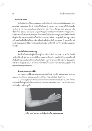 60                                                                       âÃ¤àª×ÍÃÒ·Õ¼ÇË¹Ñ§ªÑ¹ÅÖ¡
                                                                               é    è Ô     é

1. Sporotrichosis
          à»š¹âÃ¤µÔ´àª×éÍÃÒ·ÕèÁÕÍÒ¡ÒÃáÊ´§¢Í§ÃÍÂâÃ¤·Õè¼ÔÇË¹Ñ§Ã‹ÇÁ¡Ñº¡ÒÃµÔ´àª×éÍ·ÕèËÅÍ´¹éíÒàËÅ×Í§
(lymphatic involvement) ÁÕ¡ÒÃ´íÒà¹Ô¹âÃ¤·ÕàÃ×ÍÃÑ§ áÅÐÁÕÃÒÂ§Ò¹¡ÒÃ¡ÃÐ¨ÒÂ¢Í§âÃ¤ä»ÂÑ§ºÃÔàÇ³Í×¹
                                            è é                                               è
¢Í§Ã‹Ò§¡ÒÂ àª‹¹ ¡ÃÐ´Ù¡áÅÐÍÇÑÂÇÐÀÒÂã¹Ã‹Ò§¡ÒÂ àª×ÍÃÒ¡‹ÍâÃ¤ ¤×Í Sporothrix schenckii à»š¹
                                                      é
àª×éÍÃÒ·ÕèÁÕ 2 ÃÙ»áºº (dimorphic fungi) ÍÒÈÑÂÍÂÙ‹ã¹ÊÔè§áÇ´ÅŒÍÁµÒÁ¸ÃÃÁªÒµÔâ´Â¨ÐÍÂÙ‹ã¹ÃÙ»¢Í§
¡ÒÃÊÃŒÒ§ÊÒÂÃÒã¹¸ÃÃÁªÒµÔ (mold) áµ‹àÁ×ÍÁÕ¡ÒÃµÔ´àª×Íà¢ŒÒÊÙÃÒ§¡ÒÂ¨ÐÍÂÙã¹ÃÙ»¢Í§ÂÕÊµ ¡ÒÃµÔ´àª×Í
                                          è         é       ‹‹       ‹                          é
à¢ŒÒÊÙ¼ÇË¹Ñ§¼‹Ò¹·Ò§ºÒ´á¼Å·Õ»¹à»„Í¹àª×Í¨Ò¡¡ÒÃ¶Ù¡Ë¹ÒÁ·ÔÁµíÒ ¡ÒÃ¶Ù¡ÊÑµÇ àª‹¹ Ë¹Ù ¡ÃÐµ‹ÒÂ,
      ‹ Ô                         è     œ é                    è
ÊØ¹¢, áÁÇ ¡Ñ´áÅŒÇÁÕàª×Í»¹à»„Í¹¨Ò¡ÊÔ§áÇ´ÅŒÍÁ¼‹Ò¹à¢ŒÒÊÙ¼ÇË¹Ñ§ºÃÔàÇ³ºÒ´á¼Å ÁÕÃÒÂ§Ò¹ÍØºµ¡ÒÃ³
    Ñ                 é       œ       è                 ‹ Ô                             Ñ Ô
¢Í§âÃ¤ã¹á¶º»ÃÐà·È·ÕÁÍÒ¡ÒÈÃŒÍ¹áÅÐÃŒÍ¹ª×¹ àª‹¹ áÍ¿ÃÔ¡ÒãµŒ, àÁ¡«Ôâ¡, ºÃÒ«ÔÅ áÅÐ»ÃÐà·È
                          è Õ                   é
ã¹àÍàªÕÂ

        ¾ÂÒ¸ÔÊÃÕÃÇÔ·ÂÒáÅÐÊÒàËµØ
        àÁ×Íàª×Í¡‹ÍâÃ¤¼‹Ò¹à¢ŒÒÊÙ¼ÇË¹Ñ§¢Í§¼Ù»ÇÂ ¨ÐÁÕÃÐÂÐ¿˜¡µÑÇ »ÃÐÁÒ³ 7 – 30 ÇÑ¹ ¡‹Í¹à¡Ô´
           è é                  ‹ Ô        Œ †
ÃÍÂâÃ¤·Õè¼ÔÇË¹Ñ§ ¼ÙŒ»†ÇÂºÒ§ÃÒÂ¨ÐäÁ‹ÁÕÍÒ¡ÒÃáÊ´§¢Í§âÃ¤áµ‹µÃÇ¨¾ºÁÕÀÙÁÔµŒÒ¹·Ò¹µ‹Íàª×éÍâÃ¤¹Õé
à¡Ô´¢Ö¹ä´Œ â´Âà©¾ÒÐã¹¤¹·Õ·Ò§Ò¹à¡ÕÂÇ¡Ñº¾×ª¼Ñ¡ â´Â·íÒ¡ÒÃ·´ÊÍº·Õ¼ÇË¹Ñ§´ŒÇÂ Sporotrichin
      é                     è í      è                            è Ô
ãËŒ¼ÅºÇ¡ ã¹¼ÙŒ»†ÇÂàÍªäÍÇÕ ¾ºÁÕÃÒÂ§Ò¹¡ÒÃµÔ´àª×éÍáºº¡ÃÐ¨ÒÂã¹ËÅÒÂÃÐºº¢Í§Ã‹Ò§¡ÒÂ
(disseminated sporotrichosis) (1,3)

        ÅÑ¡É³ÐÍÒ¡ÒÃ·Ò§¤ÅÔ¹Ô¡
        ÍÒ¡ÒÃáÊ´§·Ò§¤ÅÔ¹¡¢Í§ sporotrichosis áº‹§à»š¹ 2 áºº ¤×Í subcutaneous form áÅÐ
                              Ô
systemic form â´Â¾º subcutaneous from ä´ŒºÍÂ¡Ç‹ÒáÅÐáº‹§à»š¹ 2 »ÃÐàÀ· ¤×Í
                                           ‹
        1. Lymphangitic form ¾ºà»š¹á¼Åáµ¡ËÅÒÂµíÒáË¹‹§µÒÁºÃÔàÇ³á¢¹ ¢Ò, à·ŒÒ ·Õã¡ÅŒ¡º
                                                                                 è Ñ
ºÒ´á¼Å·Õàª×Íà¢ŒÒÊÙ¼ÇË¹Ñ§ â´Âá¼Å¨ÐàÃÕÂ§µÑÇà»š¹àÊŒ¹µÒÁ·Ò§à´Ô¹¹éÒàËÅ×Í§ áÅÐÁÕ¡ÒÃÍÑ¡àÊº¢Í§
          è é      ‹ Ô                                       í
·‹Í¹éÒàËÅ×Í§Ã‹ÇÁ´ŒÇÂ ( ÃÙ»·Õ1)
     í                      è




                  ÃÙ»·Õè 1 ÃÍÂâÃ¤µÒÁá¹Ç·‹Í¹éíÒàËÅ×Í§ã¹ sporotrichosis
 