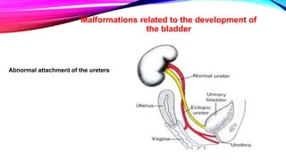 Development of Urinary Bladder | PPT