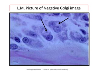 L.M. Picture of Negative Golgi image

Histology Department / Faculty of Medicine / Cairo University

 