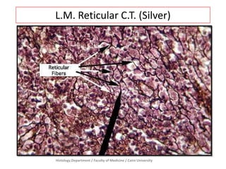 L.M. Reticular C.T. (Silver)

Histology Department / Faculty of Medicine / Cairo University

 