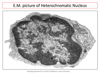 E.M. picture of Heterochromatic Nucleus

Histology Department / Faculty of Medicine / Cairo University

 