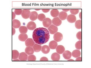 Blood Film showing Eosinophil

Histology Department/ Faculty of Medicine/ Cairo University

 