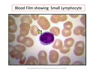 Blood Film showing Small Lymphocyte

Histology Department/ Faculty of Medicine/ Cairo University

 