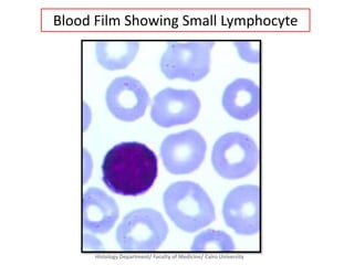 Blood Film Showing Small Lymphocyte

Histology Department/ Faculty of Medicine/ Cairo University

 