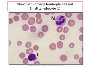 Blood Film showing Neutrophil (N) and
Small Lymphocyte (L)

N

L
Histology Department/ Faculty of Medicine/ Cairo University

 
