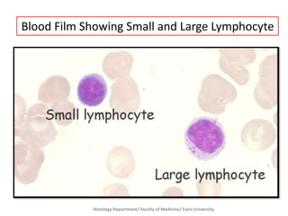 Blood Film Showing Small and Large Lymphocyte

Histology Department/ Faculty of Medicine/ Cairo University

 