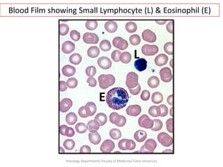 Blood Film showing Small Lymphocyte (L) & Eosinophil (E)

L
E

Histology Department/ Faculty of Medicine/ Cairo University

 