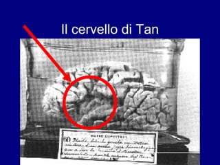 Il cervello di Tan 
 