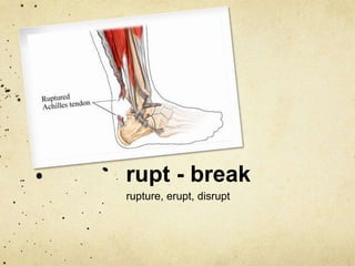 rupt - break 
rupture, erupt, disrupt 
 