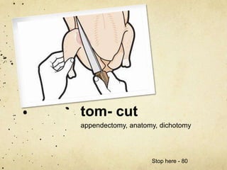 tom- cut 
appendectomy, anatomy, dichotomy 
Stop here - 80 

