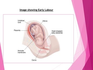 Image showing Early Labour
 
