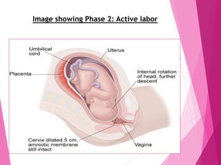 Image showing Phase 2: Active labor
 