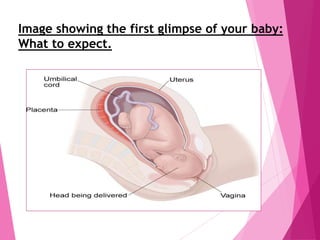 Image showing the first glimpse of your baby:
What to expect.
 