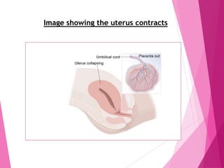 Image showing the uterus contracts
 