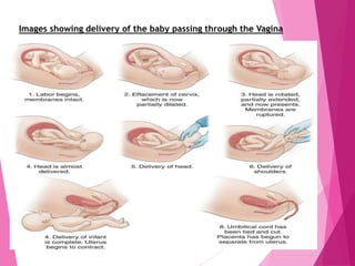 Images showing delivery of the baby passing through the Vagina
 