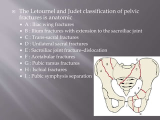 Jude Letournel Classification All about pelvic | PPTX