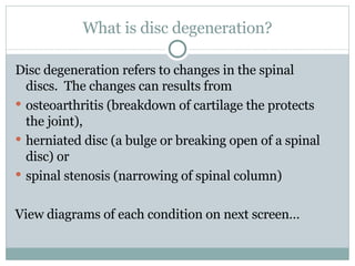 What is disc degeneration? Disc degeneration refers to changes in the spinal discs.  The changes can results from  osteoarthritis (breakdown of cartilage the protects the joint),  herniated disc (a bulge or breaking open of a spinal disc) or  spinal stenosis (narrowing of spinal column) View diagrams of each condition on next screen… 