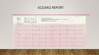 ECG/EKG REPORT
 